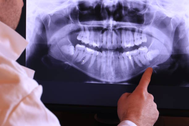 Best Emergency Treatment for Dental Infections or Abscesses in Scott City, MO
