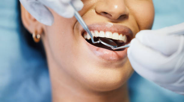 Best Emergency Wisdom Teeth Removal in Scott City, MO